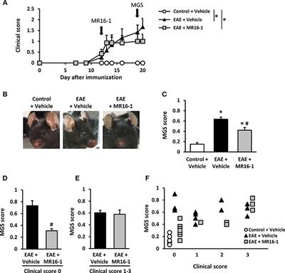 Anti-IL-6 Receptor Antibody Inhibits Spontaneous Pain at the Pre-onset of Experimental Autoimmune Encephalomyelitis in Mice